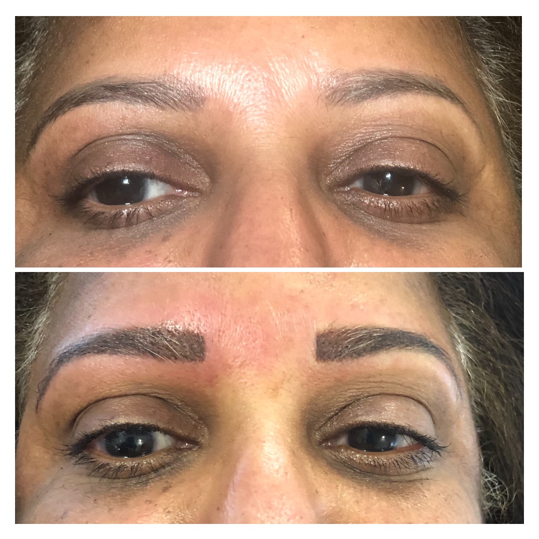 Eyebrow enhancement before and after