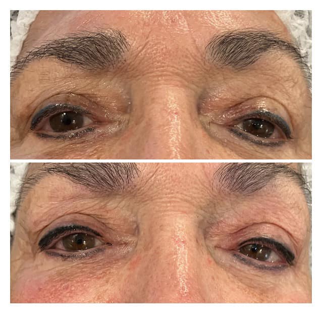 Before and after permanent eyeliner result