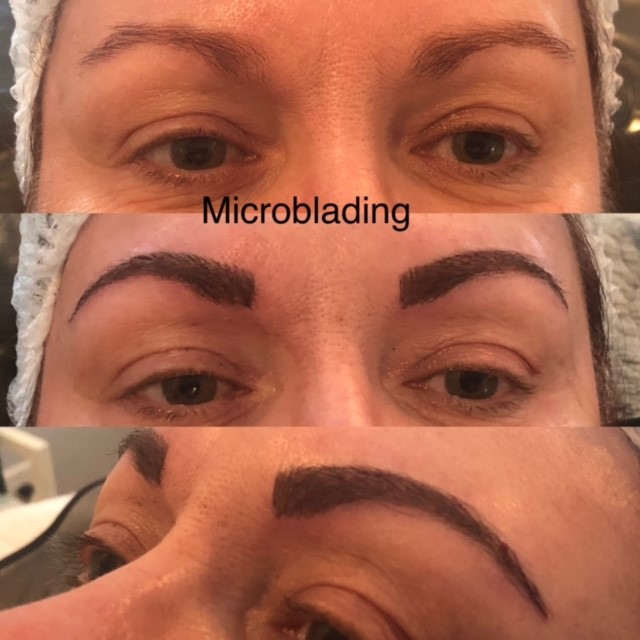 Microblading treatment progression