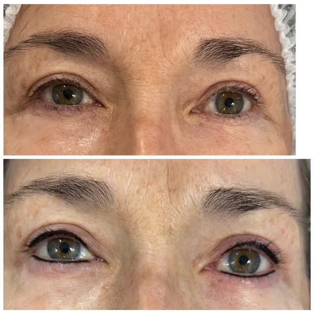 Before and after permanent makeup result