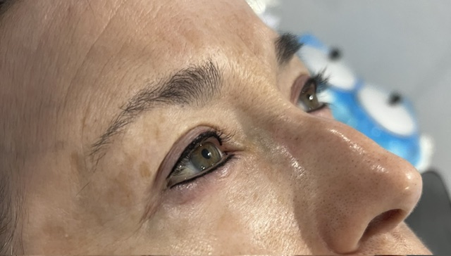 Permanent eyeliner treatment result
