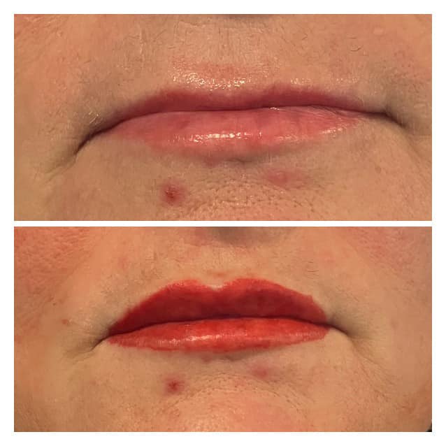 Before and after lip blush result