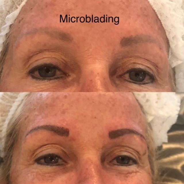 Before and after microblading result