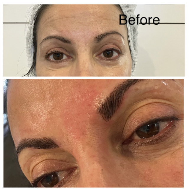 Permanent eyeliner before and after comparison